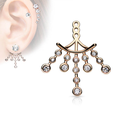 Attachment Chandelier Zirconia